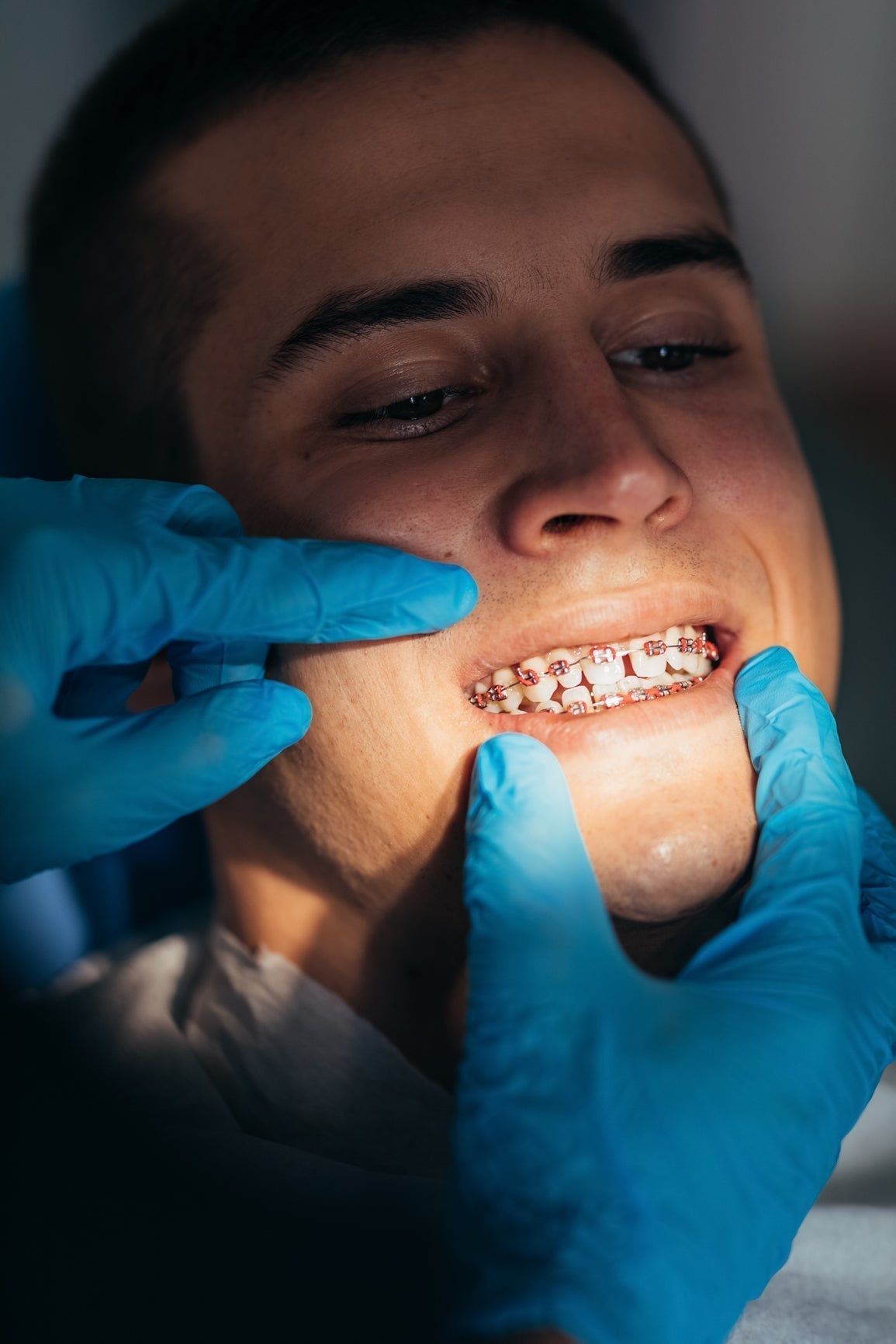 Building Healthy Habits with Fixed Braces?