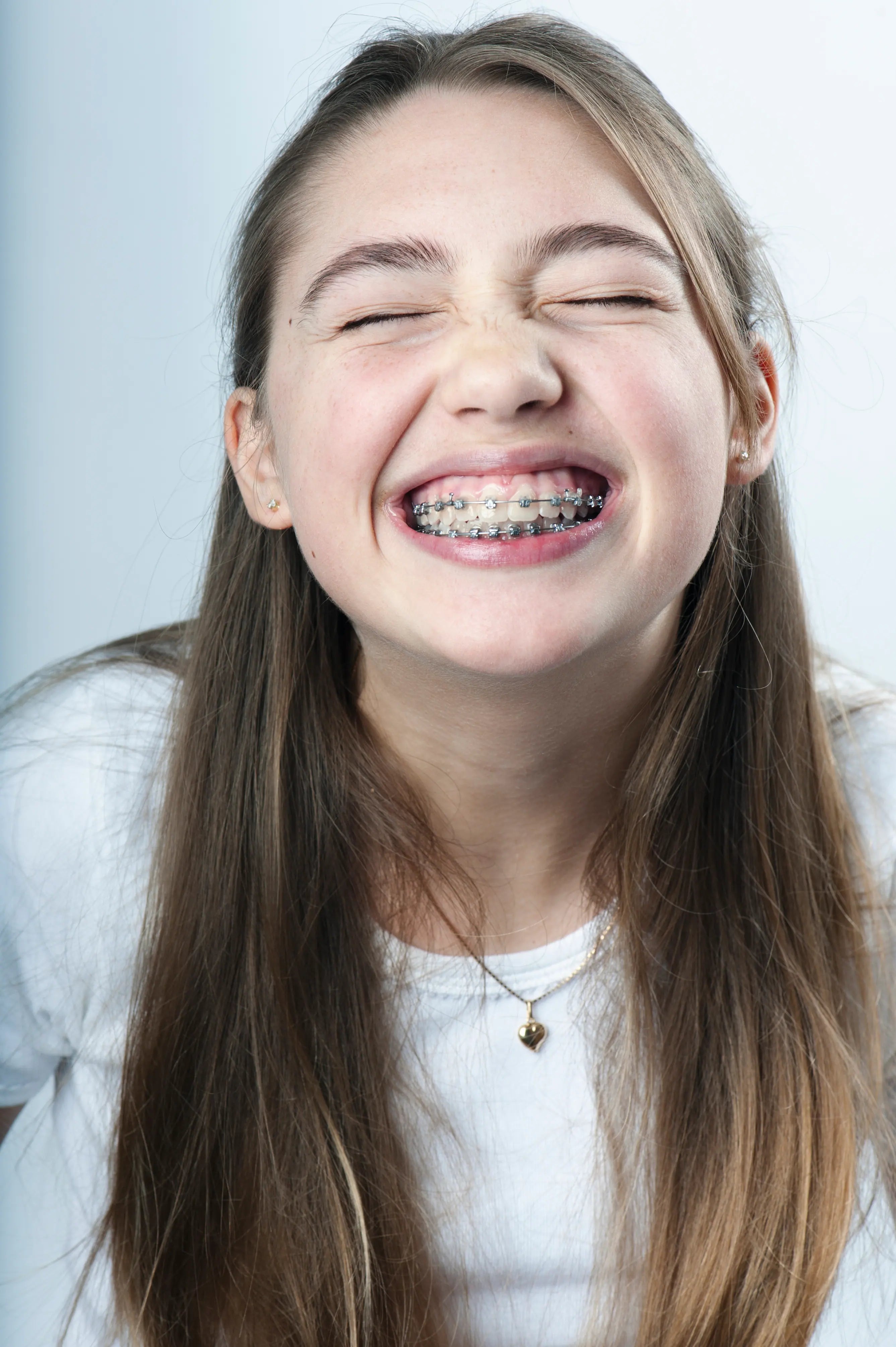 Three Ways Wearing Fixed Braces Could Unlock Whole New Levels in the Game of Life