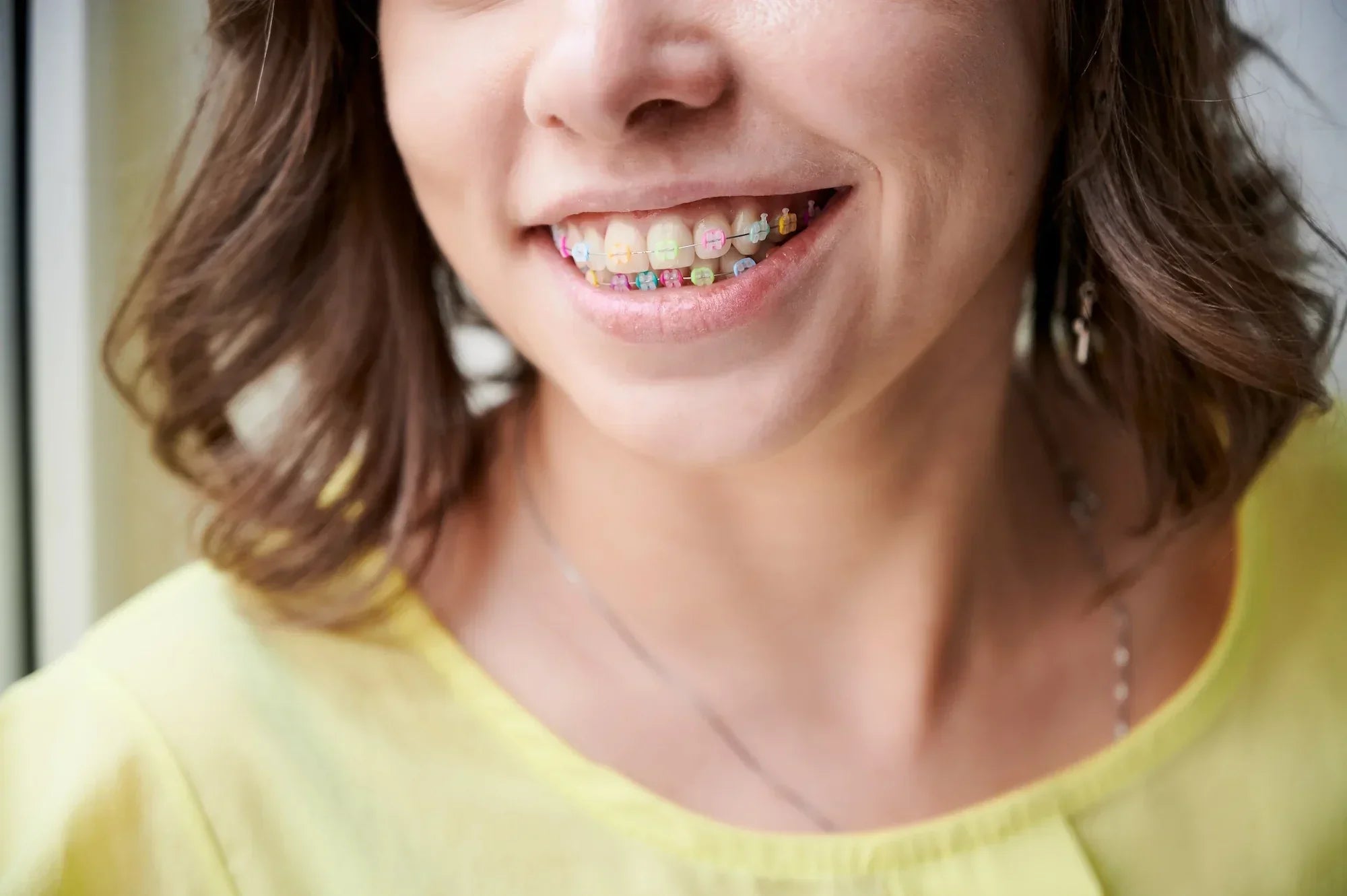 Healthy Smile Pharmacy Says Hello to The ‘Heroes Within’ Team You’ll Develop with Fixed Braces