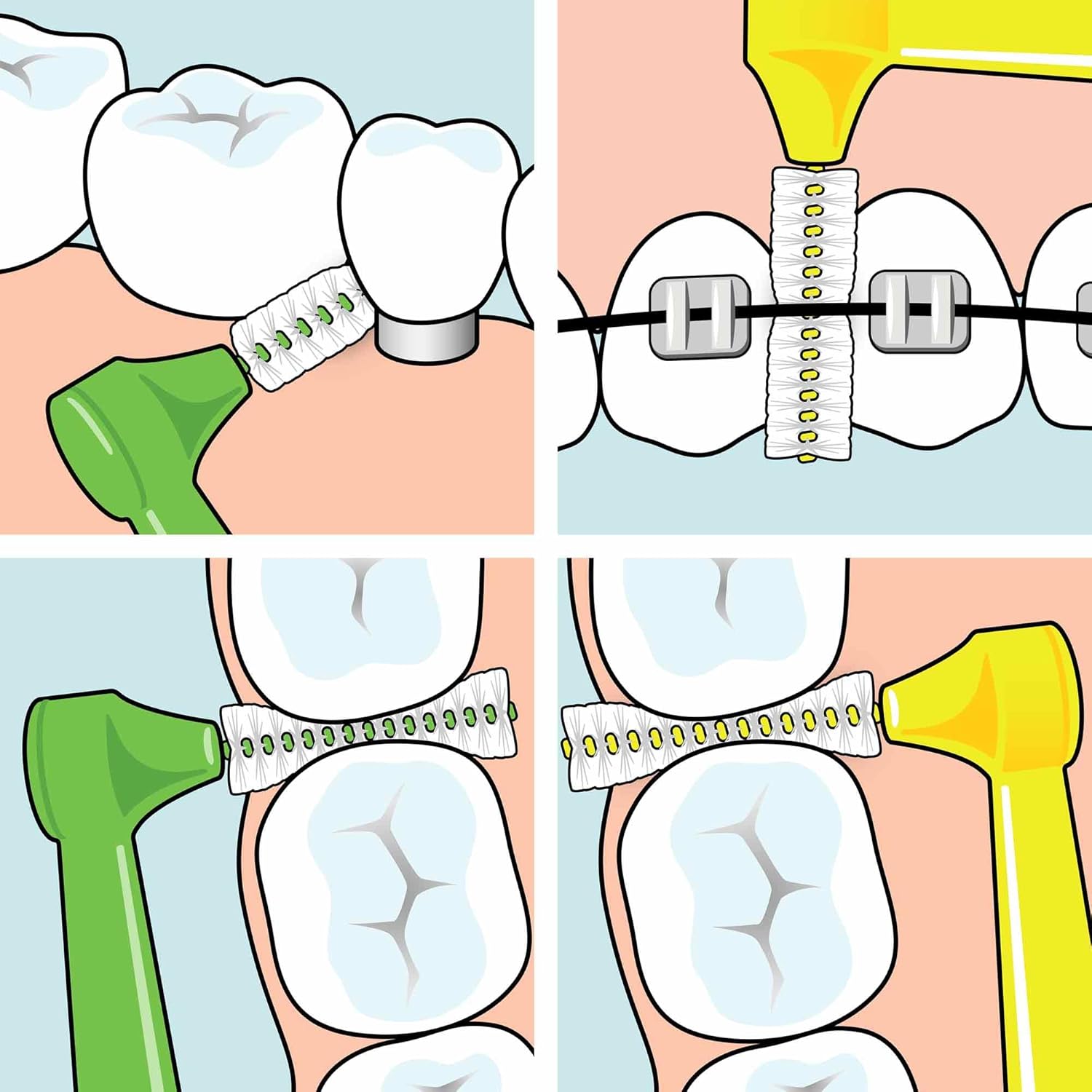 TePe Interdentals Angle 6-pack