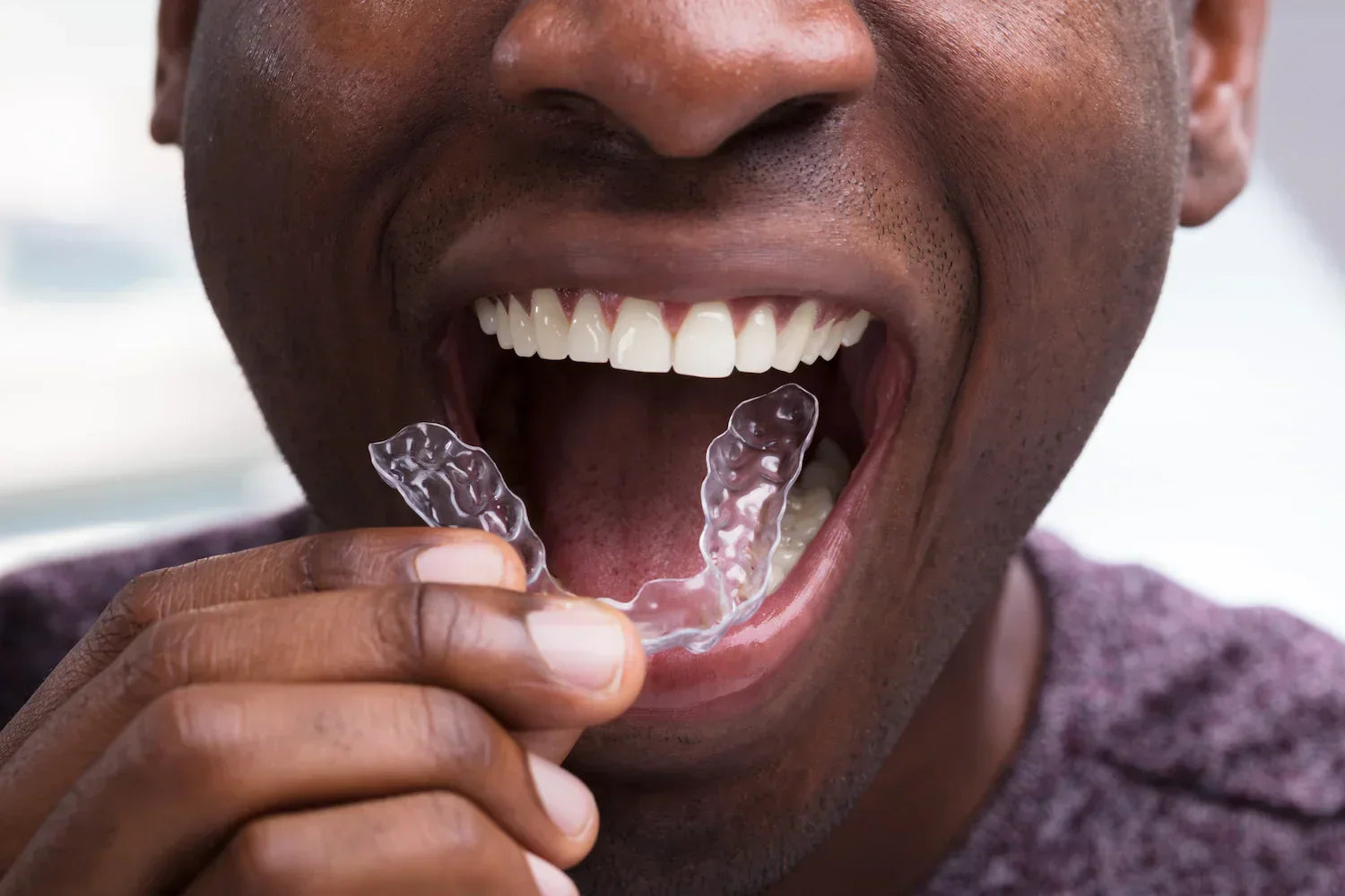 What to Do if Your Aligner Breaks