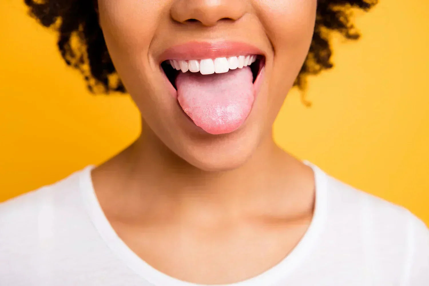 Why Tongue Care is Important After Fixed Braces