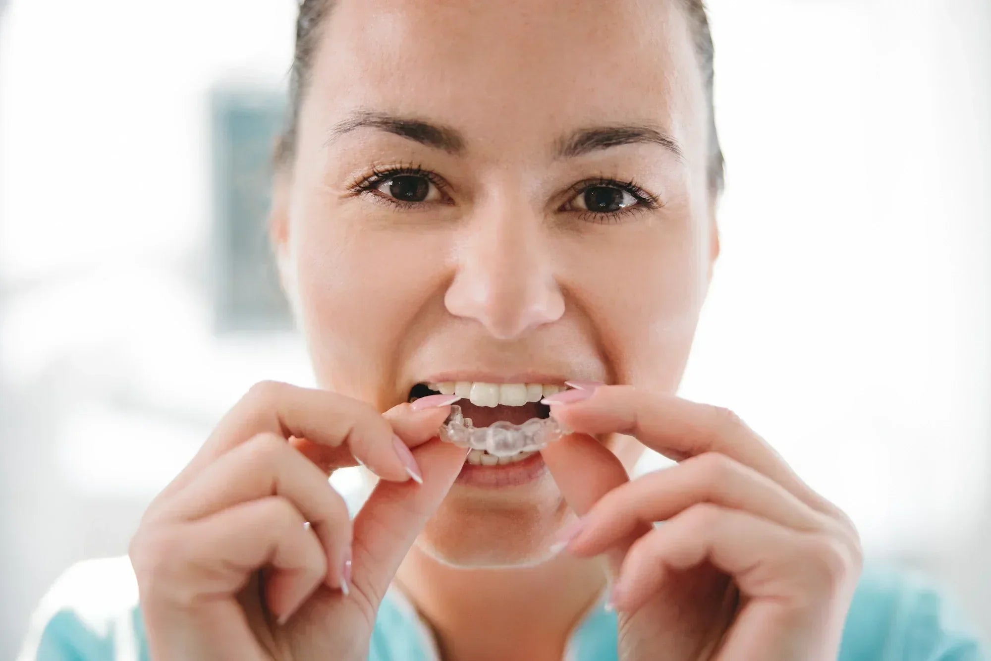 In Aligners, Your Natural Tooth Colour is the New White
