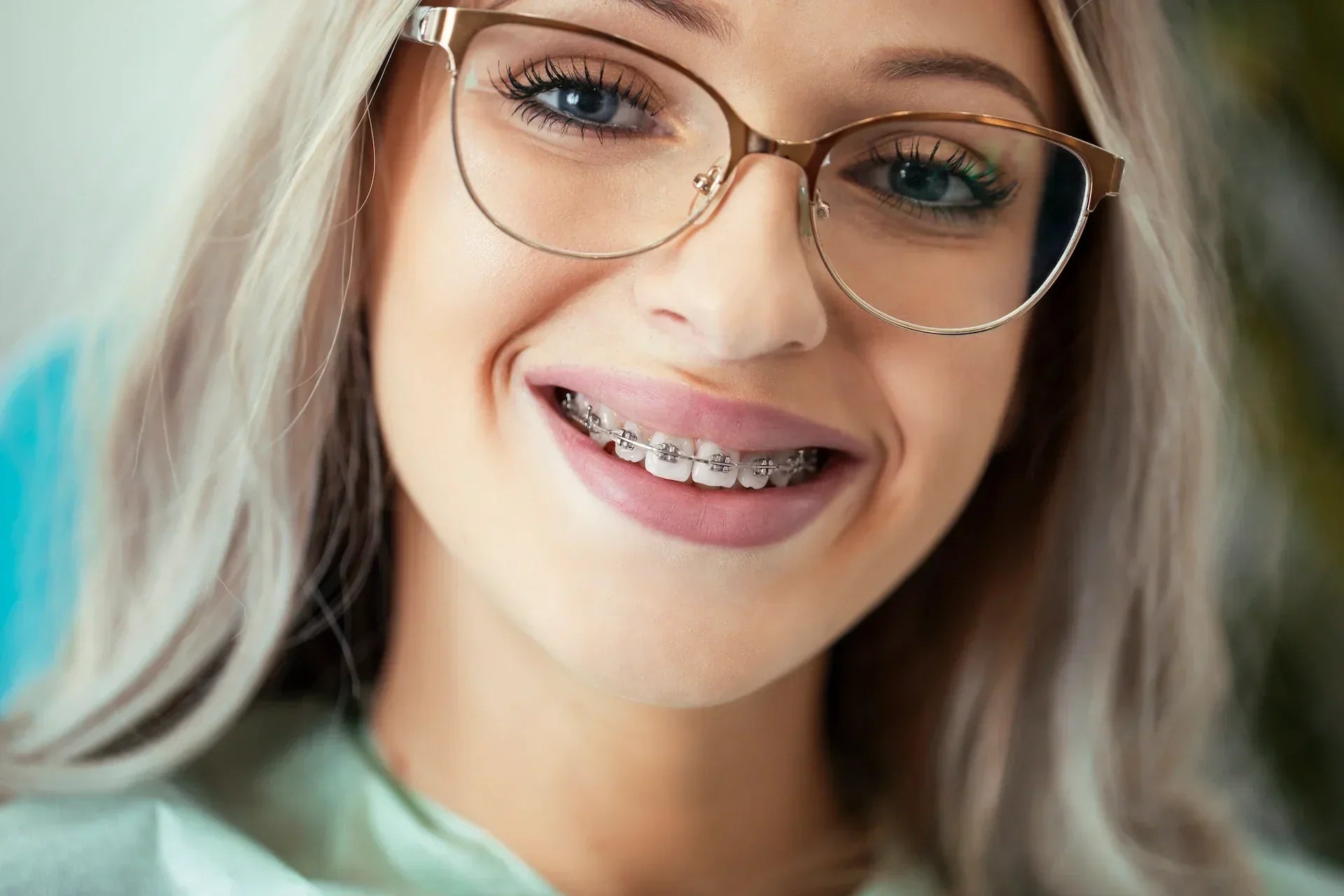 In Fixed Braces, Your Natural Tooth Colour is the New White