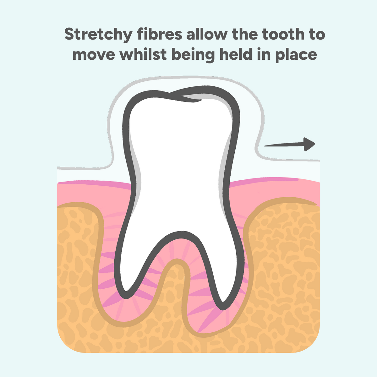 Moving Teeth with Dental Aligners | Healthy Smile Pharmacy